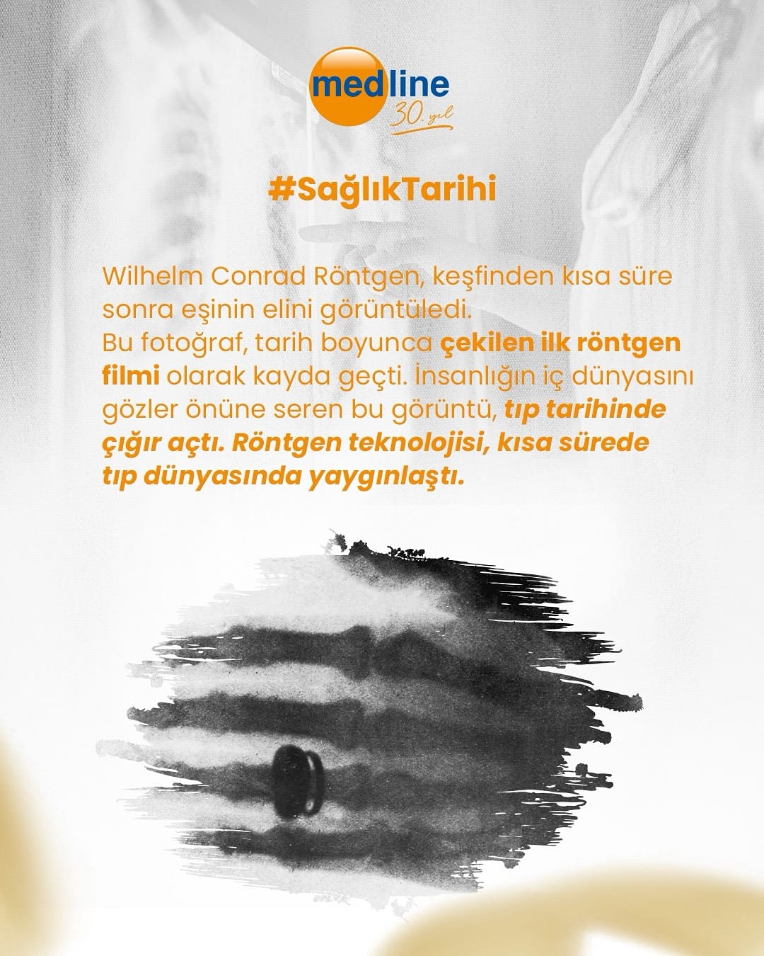 rontgenin-cihazinin-kesfi