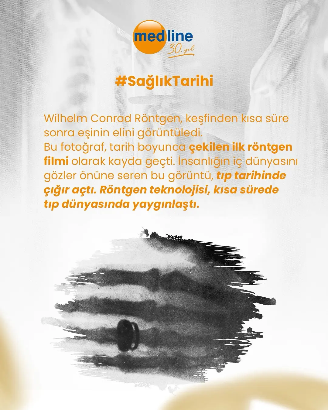 rontgenin-cihazinin-kesfi